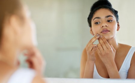 Woman with acne-prone skin looking in a mirror