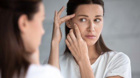 Frauen erleben verbesserte akneanfällige Haut mit Sébium Serum