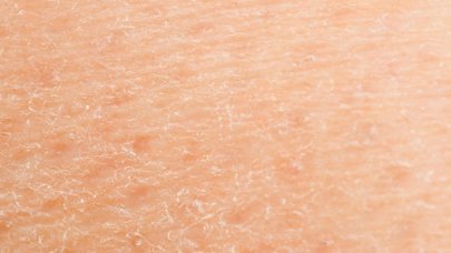 Warum Ist Meine Haut Dehydriert Bioderma Von Dermatologen Empfohlen